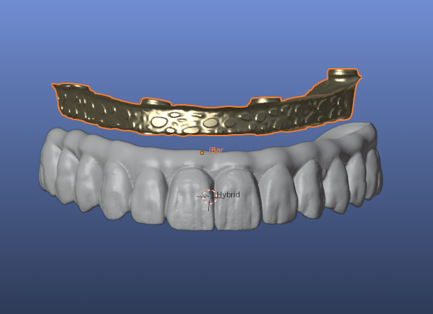 Diseño iBar con estructura Zr